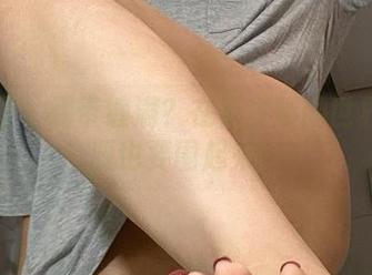 微密圈 - 绷带缠满？在于芷晴的世界里资源也要围起来！